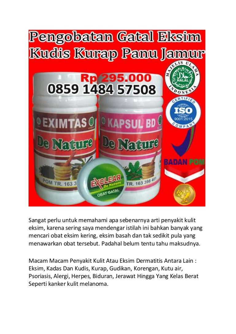 Cara Mengobati Eksim Basah Cara Mengobati Eksim Basah Yang Ampuh Dengan 4 Jenis Obat Ini