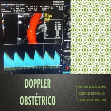 Ultrasonido obstetrico, Doppler fetal, caracteristicas