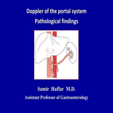 Doppler ultrasound of the portal system - Pathological findings