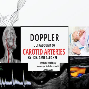 Doppler ultrasound of the carotid arteries .pptx