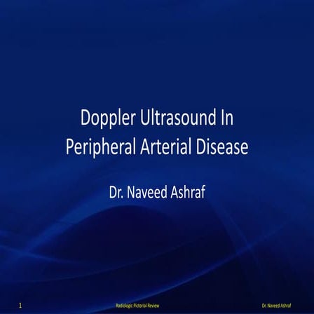 Doppler ultrasound in peripheral arterial disease
