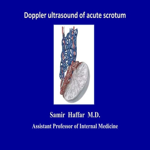 Doppler ultrasound of acute scrotum