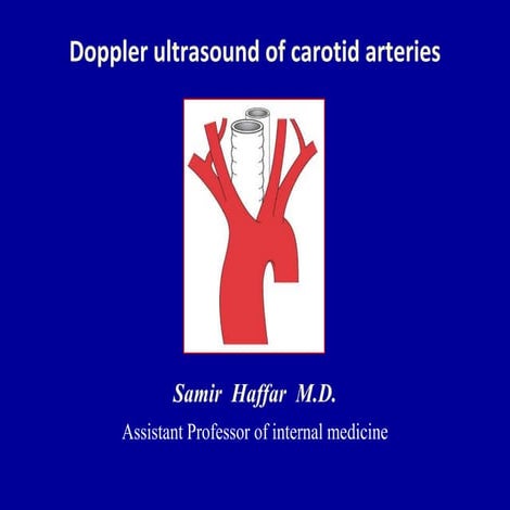 Doppler ultrasound of carotid arteries