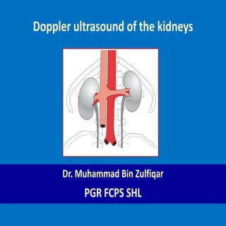 Doppler ultrasound of the kidneys 1