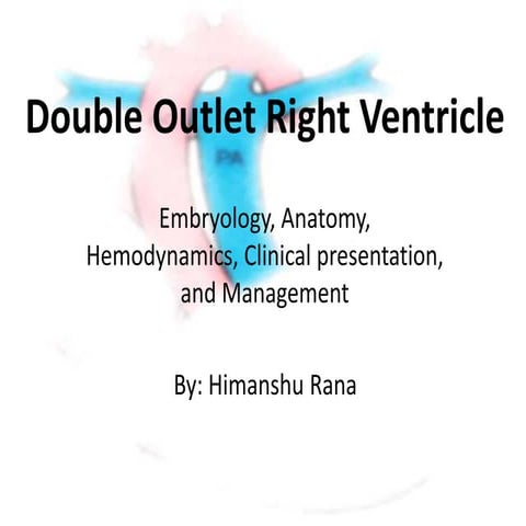 Double outlet right ventricle
