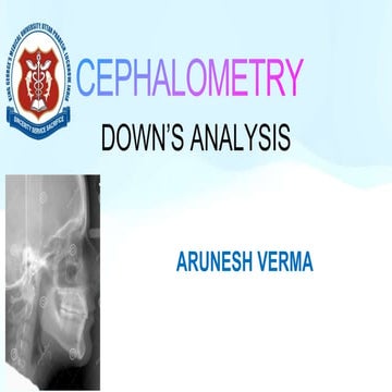 DOWNS ANALYSISS AK VERMA.pptx