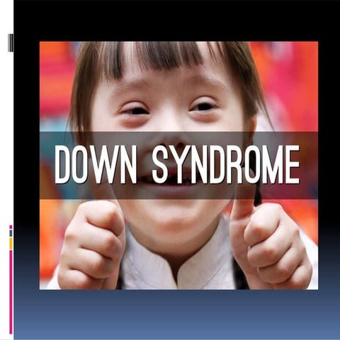 Downs syndrome Treatment and Diagnosis (trisomy 21)