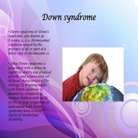 Down syndrome