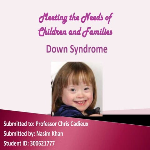 Down syndrome