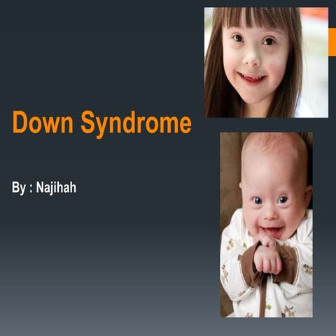 Down syndrome | PPTX