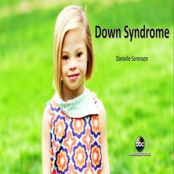 Down syndrome