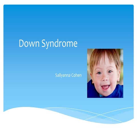 Down syndrome Class Presentation