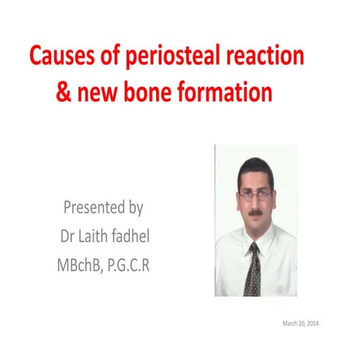 Dr.laith notes  about common causes of periosteal reaction