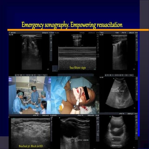 Emergency sonography. Empowering resuscitation   