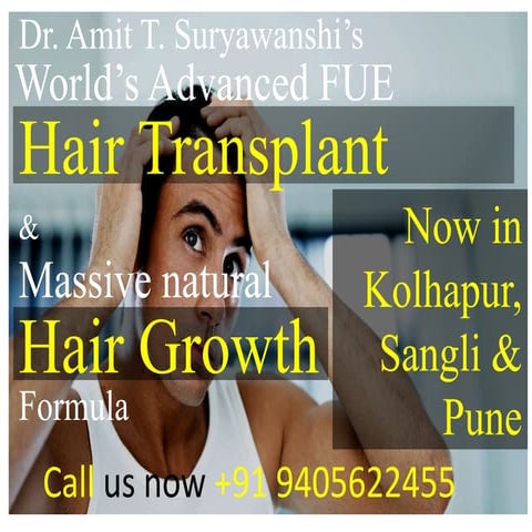 Best Hair Transplant in Kolhapur, Sangli, Pune & Mumbai.