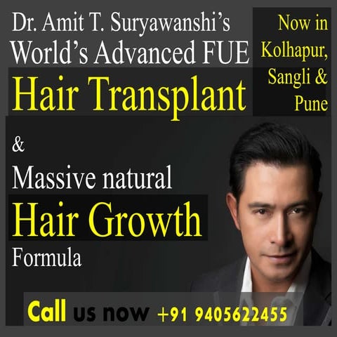 Best Hair Transplant in Sangli