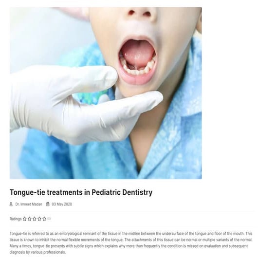 Tonguetie treatments in Pediatric Dentistry PPT