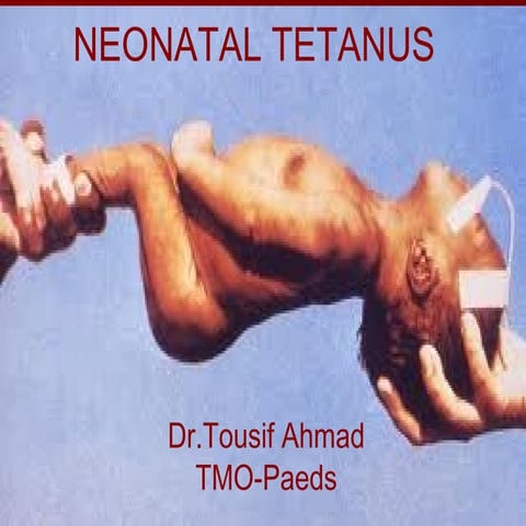 Dr.tosif tetanus in the new born