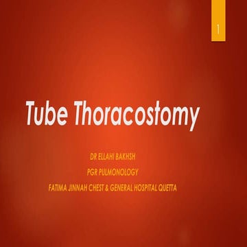 Tube Thoracostomy DR ELLAHI BAKHSH