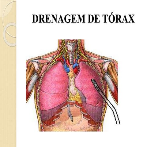 drenagem-tor-cica-m-todos-e-t-cnicas-de-aplica-o-pdf