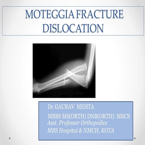 monteggia fracture