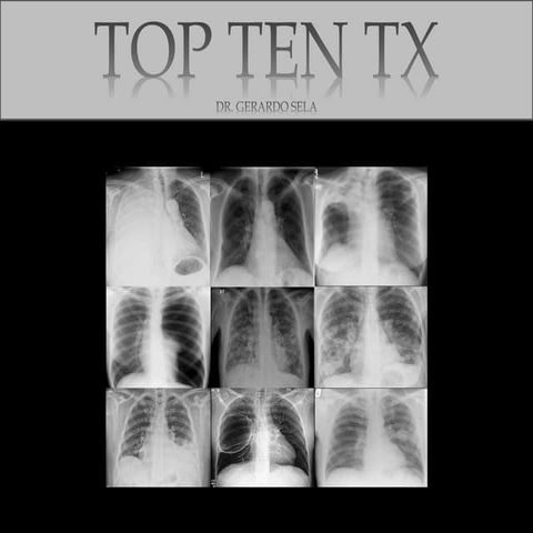 Dr gerardo sela top ten torax 2015 2