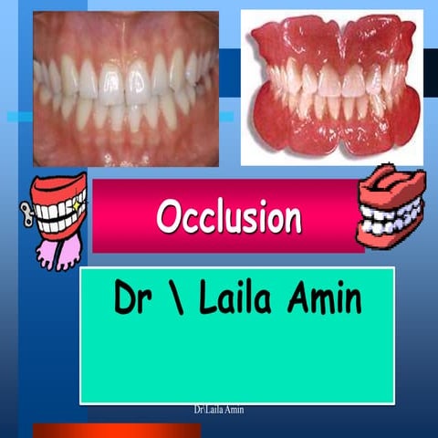 Dr laila Amin (occlusion2)