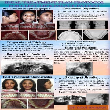 treatment protocol for cleft lip and palate patients.pptx