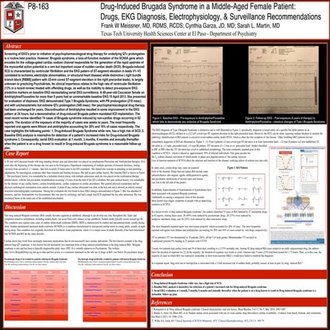 Drug induced brugadda apa