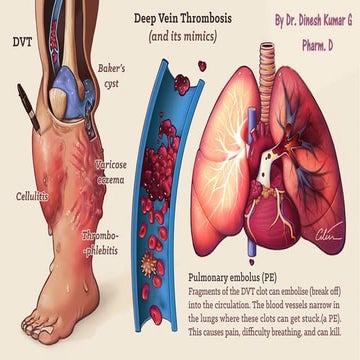 Drugs used for DVT