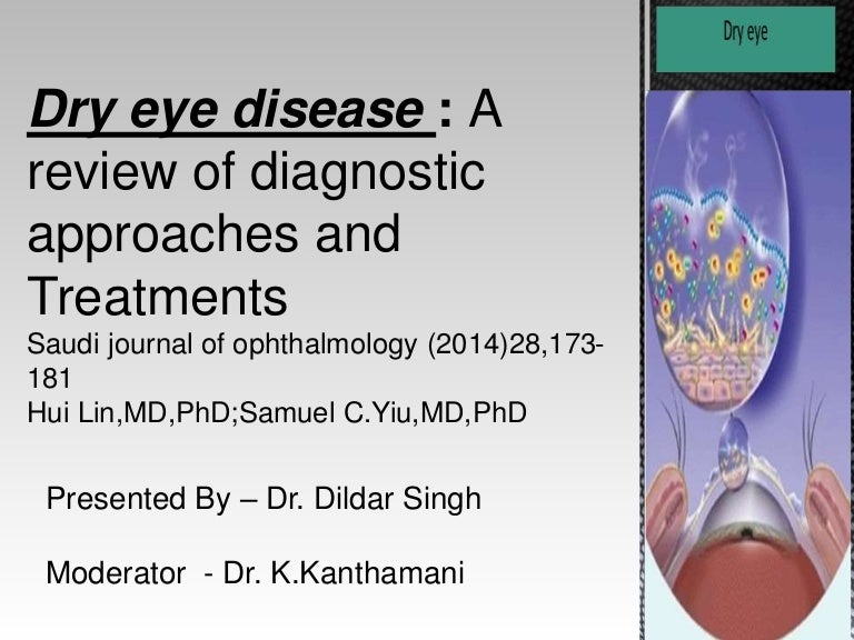 Dry eye ppt by dr dildar