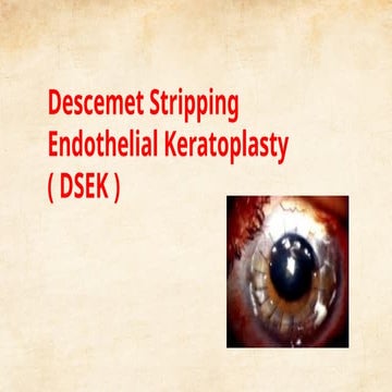 Comprehensive Overview of Descemet Stripping Endothelial Keratoplasty ...