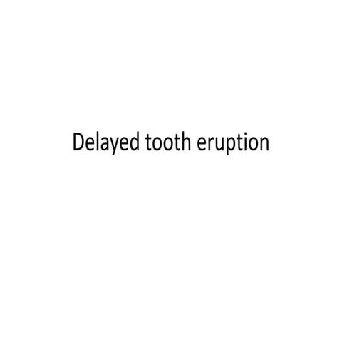 delay tooth eruption | PPTX