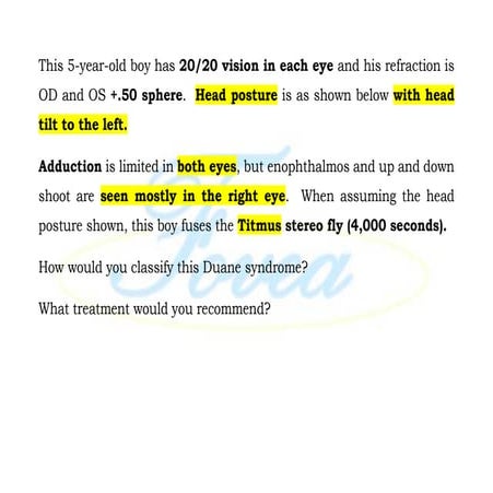 Duane Retraction Syndrome