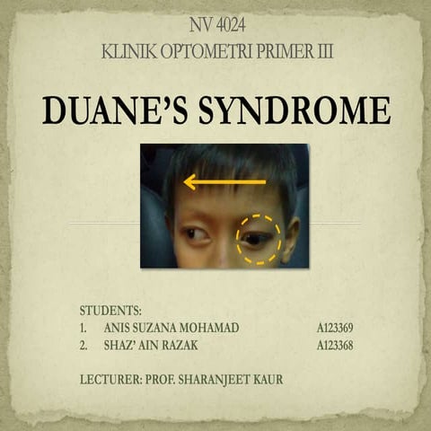 Case Presentation: Duane's Syndrome