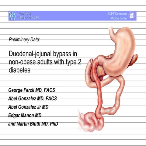 Duodenal-jejeunal Bypass in Non-obese Adults with Type 2 Diabetes | PPT