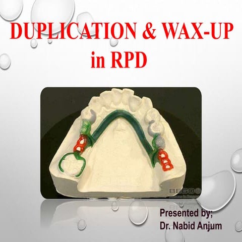 Duplication and wax up in rpd