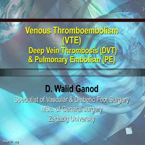 Deep vein thrombosis (dvt) | PPT