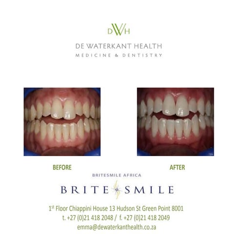 D Before & After 1 | PPTX