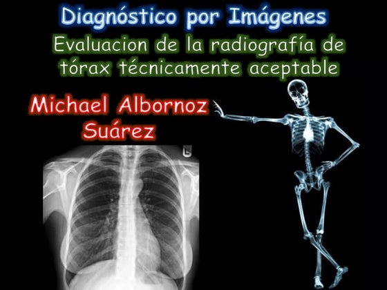 Anatomía Del Tórax Por Rayos X ABC Radiografía De Tórax