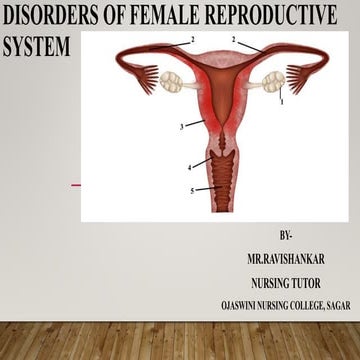 Dysmenorrhea.pdf