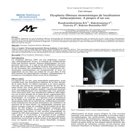 Dysplasie fibreuse tap2(1) | PDF