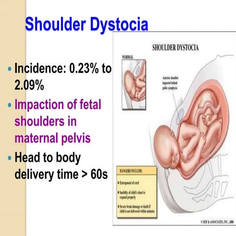 DYSTOCIA.ppt