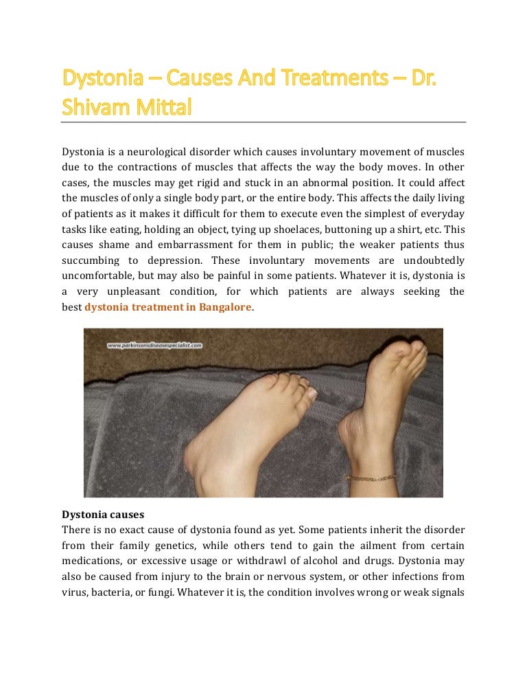 Dystonia causes and treatments