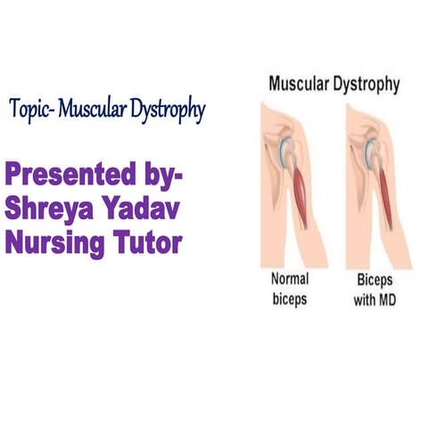 Dystrophy ppt | PPTX