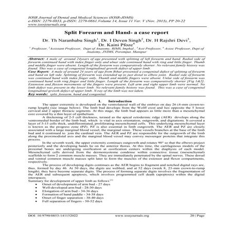Comprehensive OMT Classification System for Congenital Hand and Upper ...