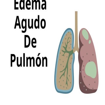 EDEMA AGUDO DE PULMÓN - NIVEL BÁSICO MEDICINA