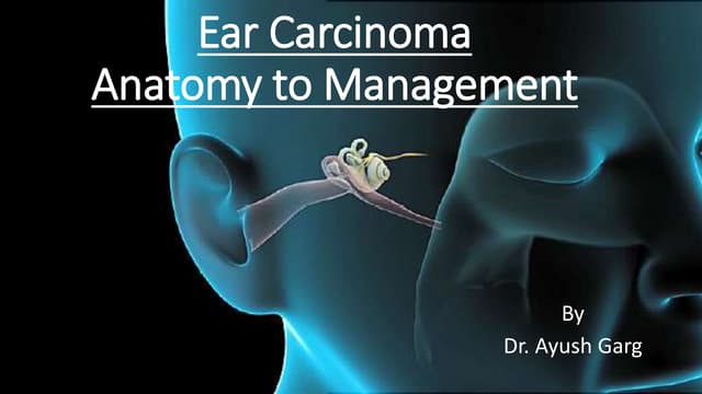 TUMORS OF EAR | PPTX