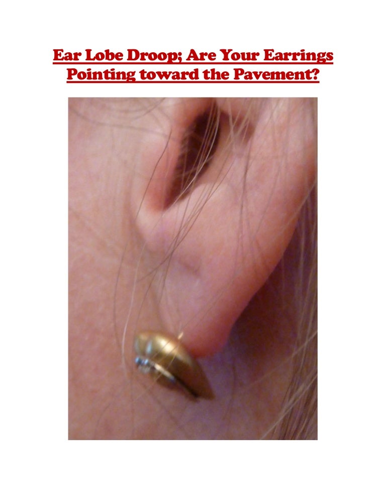 Ear lobe droop; are your earrings pointing toward the pavement