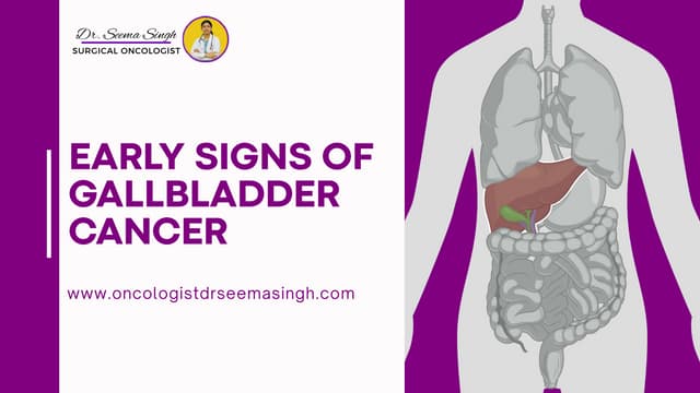 Early Signs of Gallbladder Cancer guidance